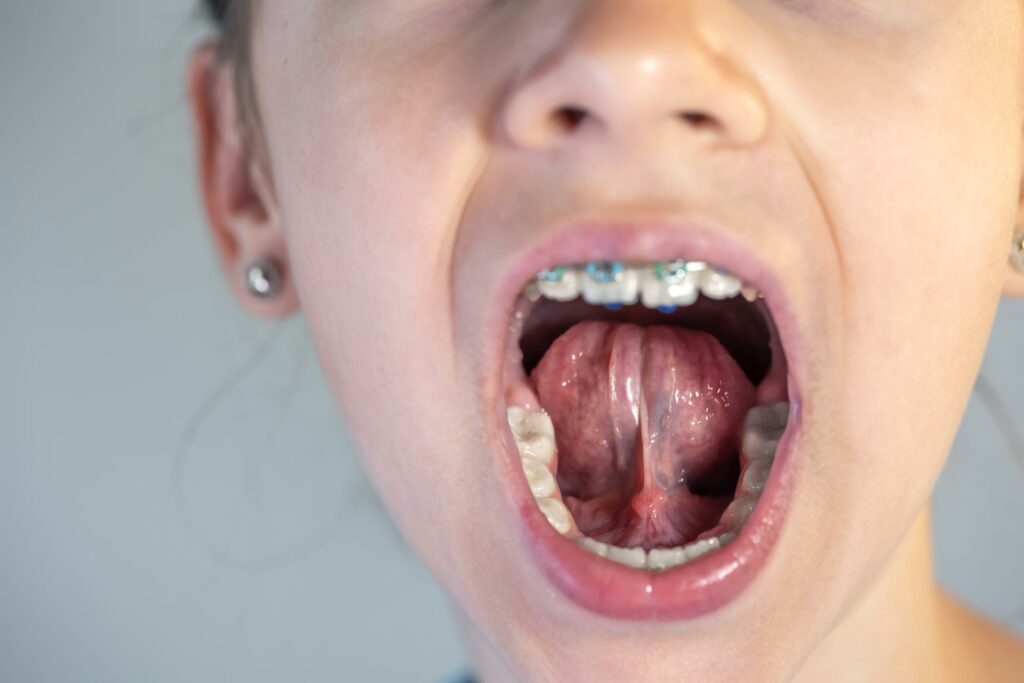 Perfectionnement OMF : la prise en soin par le thérapeute fonctionnel